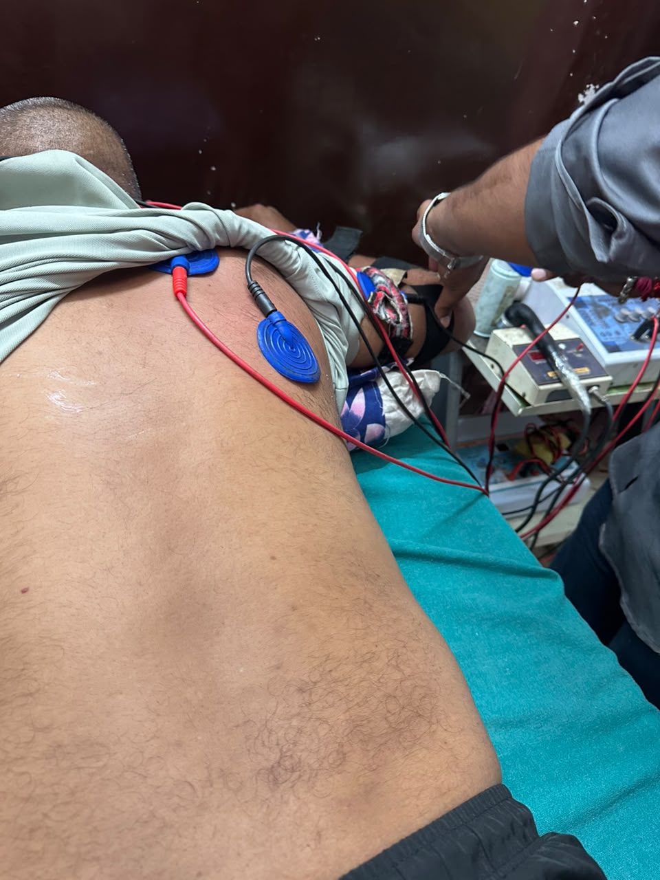 Slipped Disc & Sciatica Nerve Pain Alwar