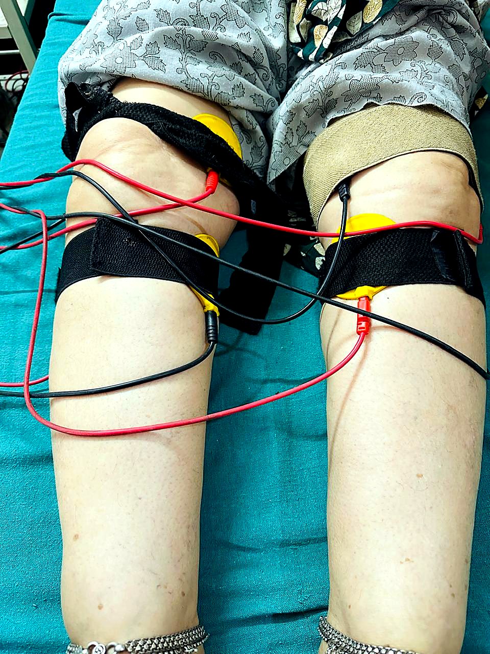 Knee Pain & Osteoarthritis Physiotherapy Alwar